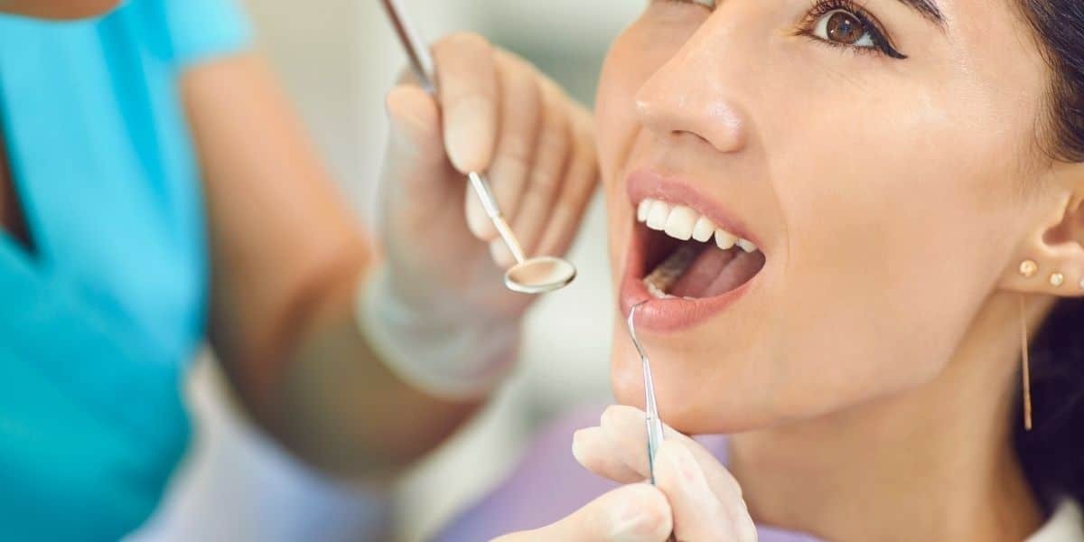 Composite Fillings