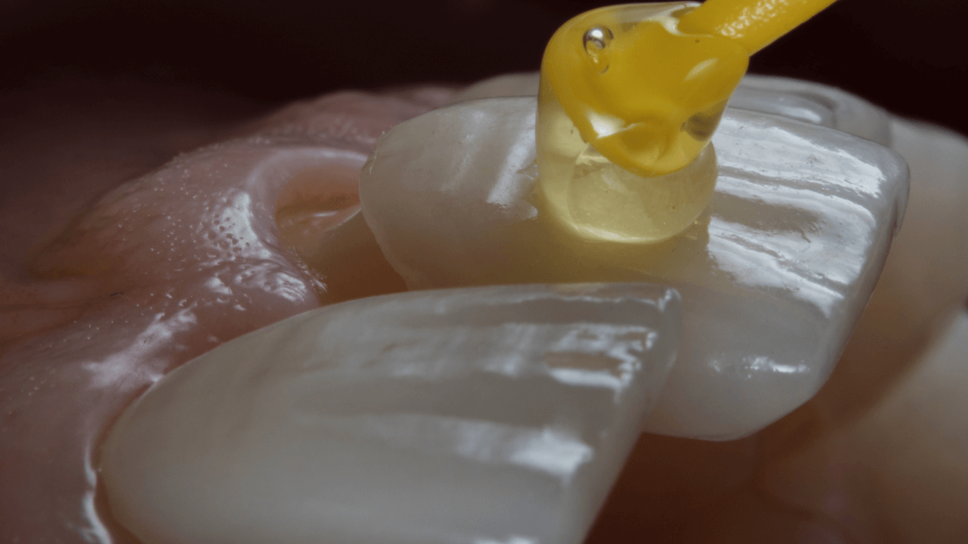cosmetic dentist hamilton