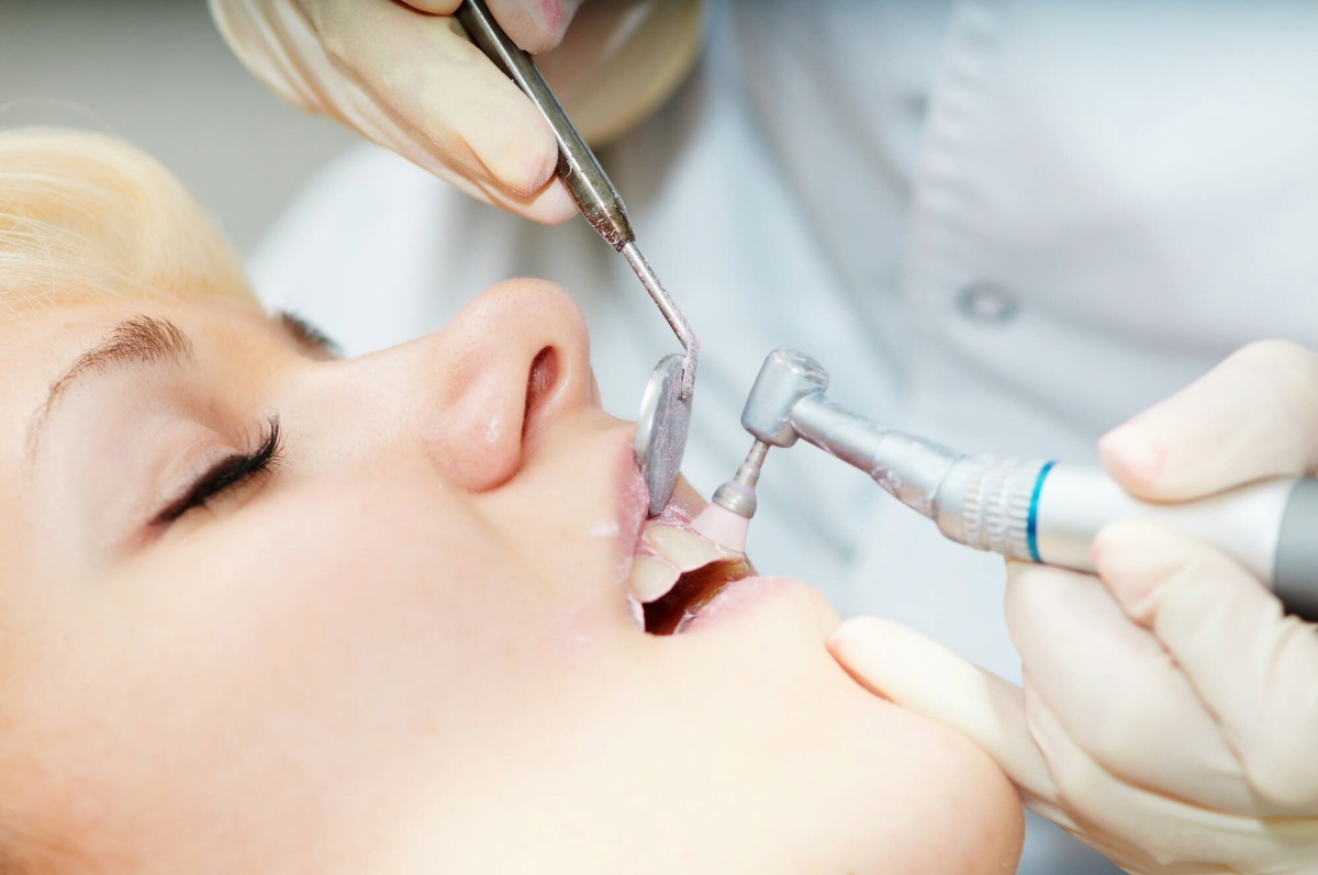 dental cleanings are more important than you think