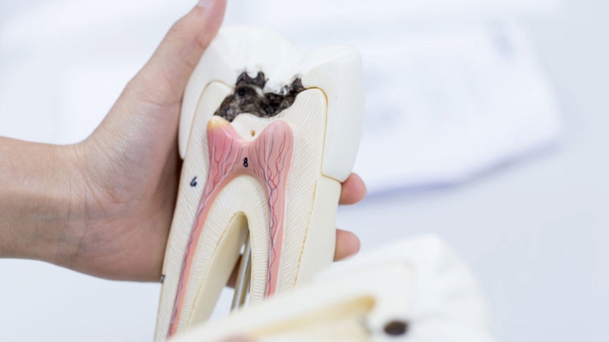 what are the early signs of cavities i should ignore