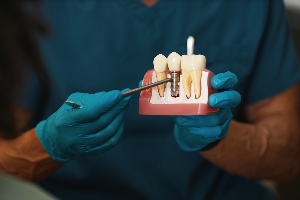 dental implants compare to dentures or bridges